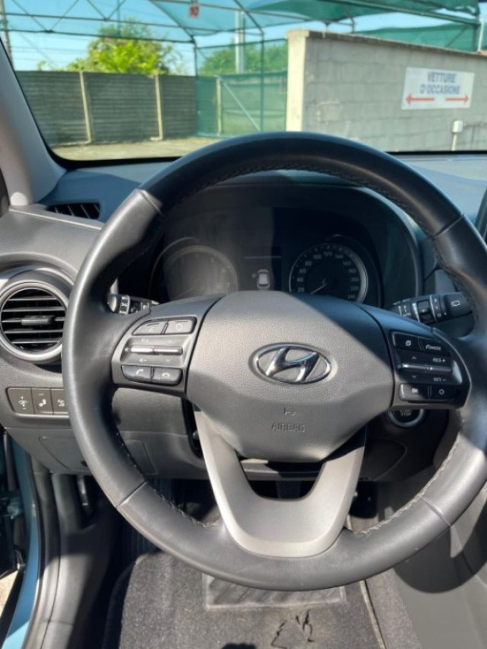 Hyundai Kona usata a Novara (5)