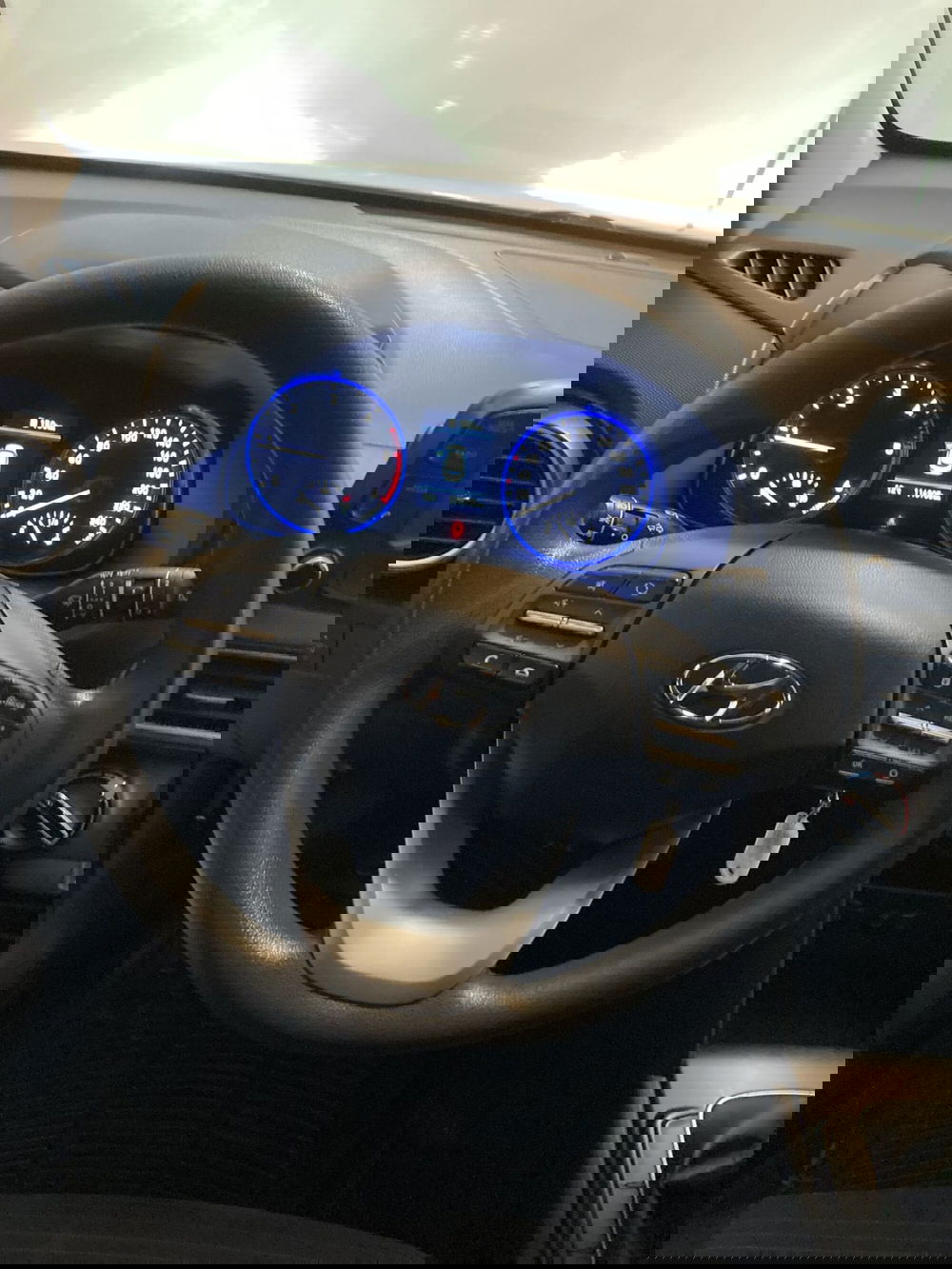 Hyundai Kona usata a Barletta-Andria-Trani (10)